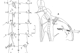 Pupa de Culex imitator. A. Cefalotórax; B. Metanoto y abdomen. GL = lóbulo genital, Mtn = metanoto, Pa = paleta, T = trompeta, I–VIII = segmentos abdominales (Foto: Bangher & Stein, 2017).