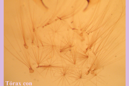 Stellate setae of thorax of Culex fernandezi (Photo: M. Laurito).