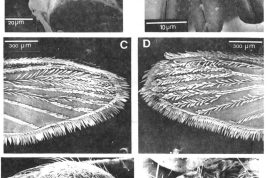 Adults of Culex oedipus. Female: A. Dorsal aspect of cibarial armature; B. Detail of figure A focusing the cibarial teeth; C. Dorsal aspect of distal right wing scaling; D. Ventral aspect of distal right wing scaling; E. Aspect of lateral right side of thorax; Male: F. Dorsal aspect of head showing forked and falcate scales (Photo: Foraytini & Mureb-Sallum, 1987).