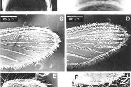Adultos de Culex plectoporpe. Hembra: A. Aspecto dorsal de la armadura cibarial; B. Detalle de la figura A enfocando los dientes cibariales; C. Aspecto dorsal del patrón de escamas del ala derecha; D. Aspecto ventral del patrón de escamas del ala derecha; E. Aspecto del lado derecho del tórax; Macho: F. Aspecto dorsal de la cabeza mostrando las escamas bifurcadas (Foto: Forattini & Mureb-Sallum, 1987).