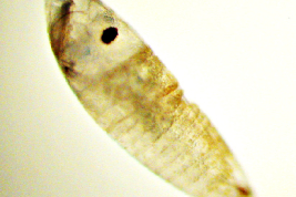 Side view of a farad larva of Ochlerotatus albifasciatus inside the diaphanized egg (Photo: R. E. Campos)