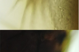 Anopheles neomaculipalpus. Arriba: cerdas larvales con forma de hojuelas y márgenes aserrados; abajo: cerda simple 9-P (Foto: Díaz Nieto et al., 2020).