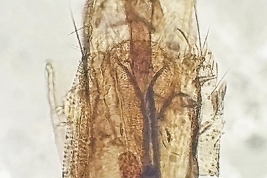Vista ventral de la genitalia femenina de Psorophora dimidiata (Foto: Stein et al., 2022).