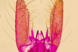 Estructuras de la genitalia masculina de Ochlerotatus terrens (Foto: M. Laurito).