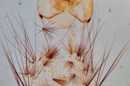 Larvae of Wyeomyia argentina (Photo: D.N. Bangher)