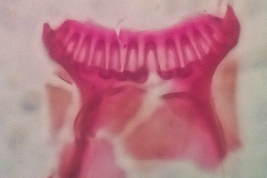 Cibarial armature of female of Culex aliciae (Photo: D. N. Bangher)
