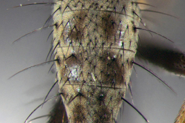 Male, abdomen