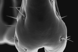 Male, cercus distal tip (Scanning)