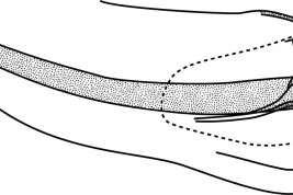 Tip of phallus, lateral view. From Sganga et al. (2022).