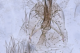 Genitalia, vista ventral.