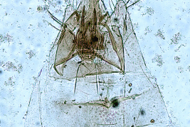 Genitalia, ventral view.