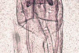 Genitalia, vista ventral.