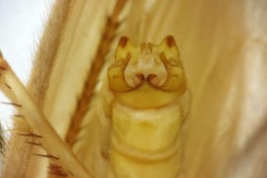 Male genitalia, ventral view (LIESA, CIEMEP)