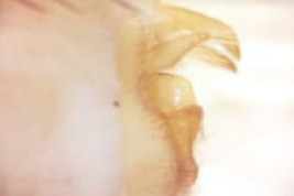 Genitalia macho, vista lateral (LIESA, CIEMEP)