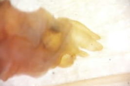 Male genitalia, lateral view (LIESA, CIEMEP)